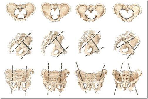 Types de pelvis feminin